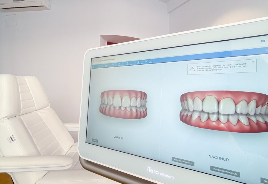 Treatment room with a 3D simulation of the teeth on the screen
