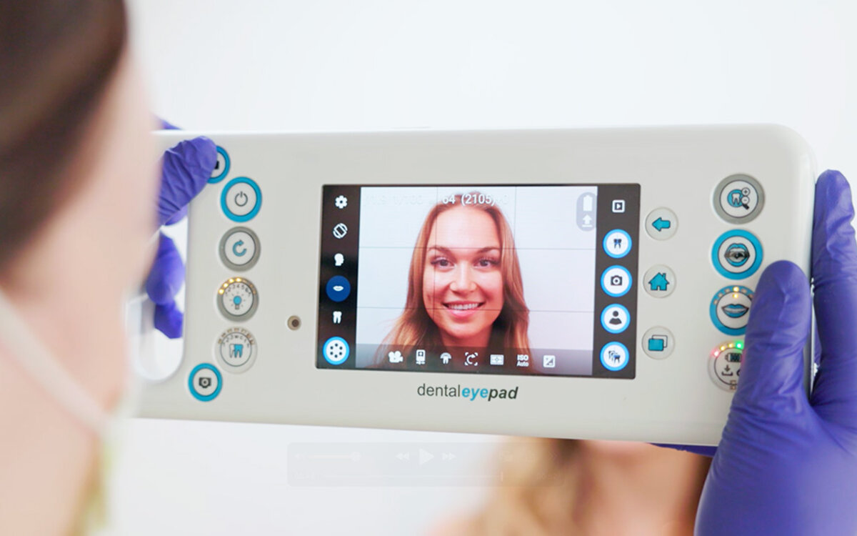 >Funktioniert eine unsichtbare Zahnspange auch bei Vorbiss oder Vorstand – oder nur bei kleinen Fehlstellungen?