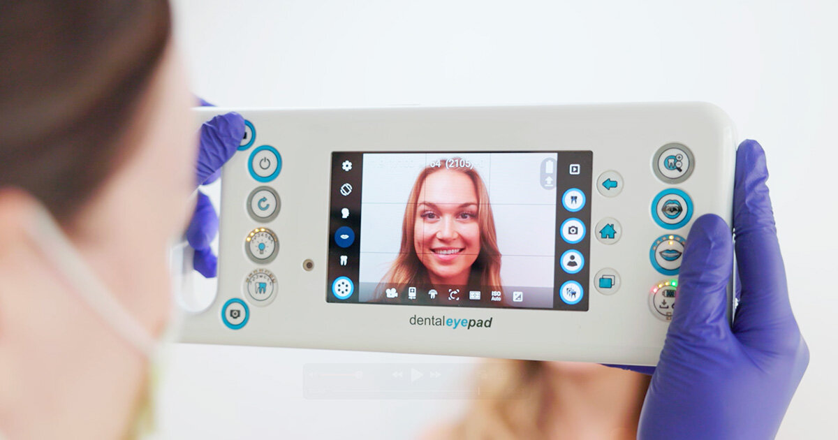 >Funktioniert eine unsichtbare Zahnspange auch bei Vorbiss oder Vorstand – oder nur bei kleinen Fehlstellungen?