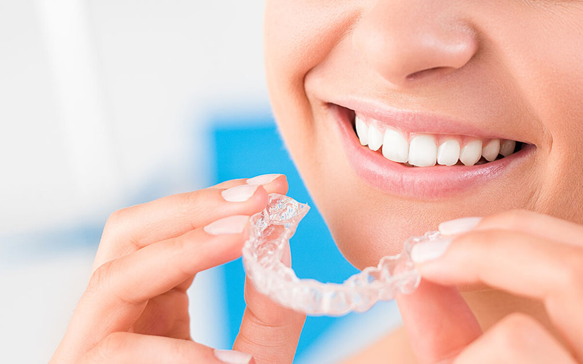 >Wie schnell sieht man erste Ergebnisse mit unsichtbaren Zahnschienen?