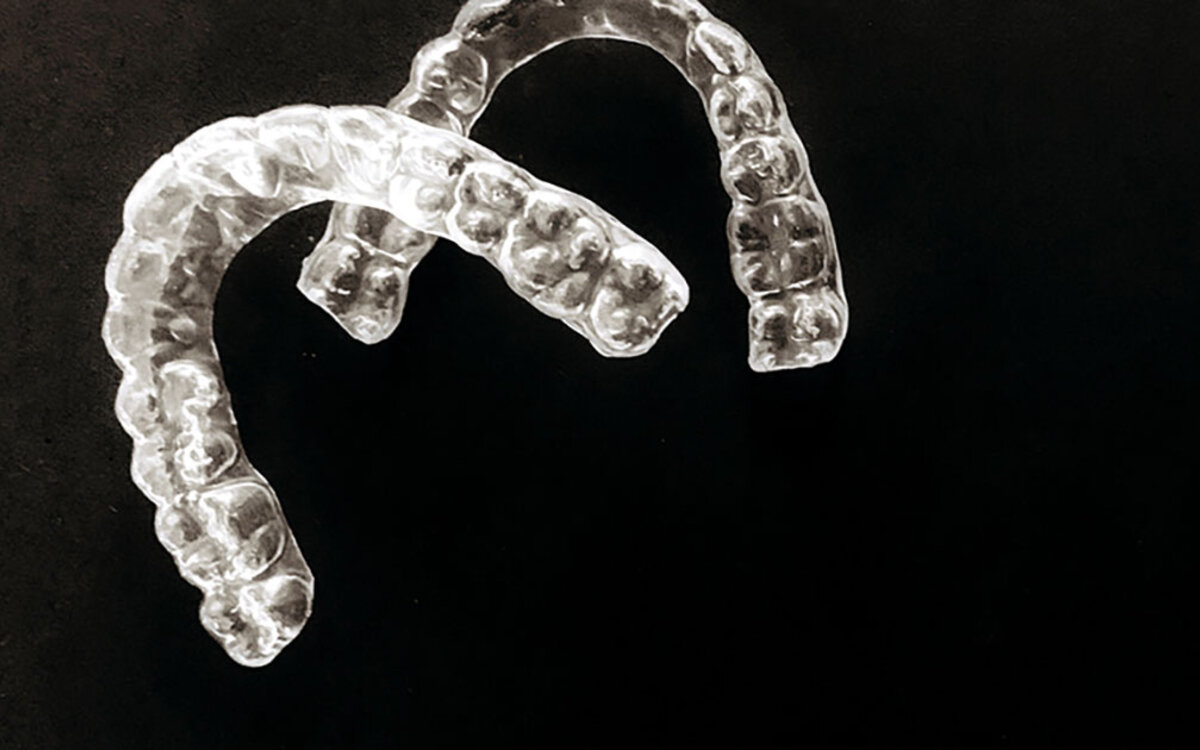 >Was kostet eine unsichtbare Zahnspange in Wien – und wovon hängt der Preis wirklich ab?