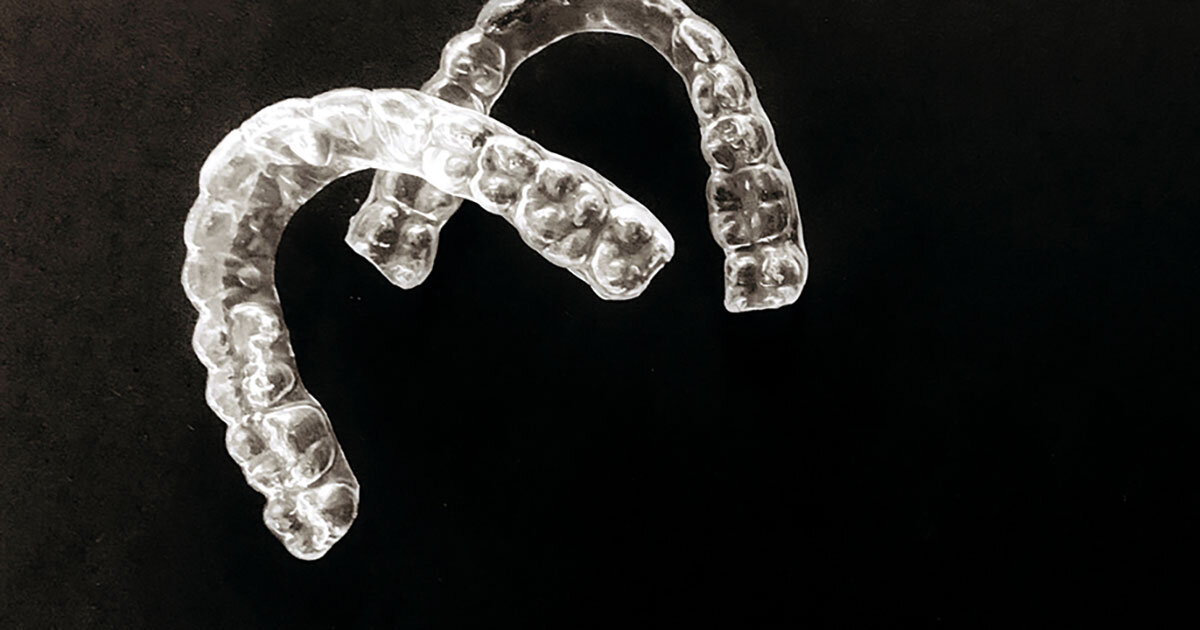 >Was kostet eine unsichtbare Zahnspange in Wien – und wovon hängt der Preis wirklich ab?