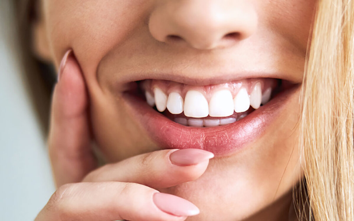 >Wie lange hält das Ergebnis nach einer unsichtbaren Zahnspange – und was sorgt für dauerhafte Stabilität?