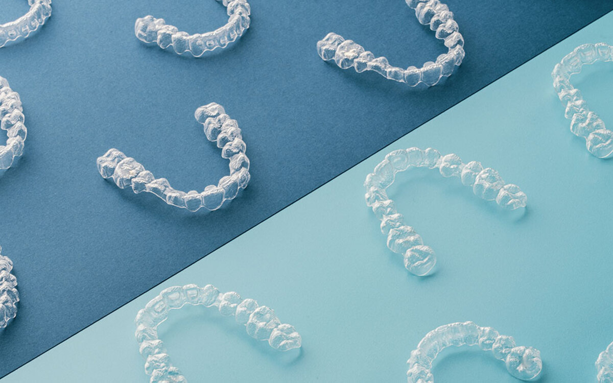 >Unsichtbare Zahnschienen im Beruf: Funktionieren sie wirklich im Arbeitsalltag?