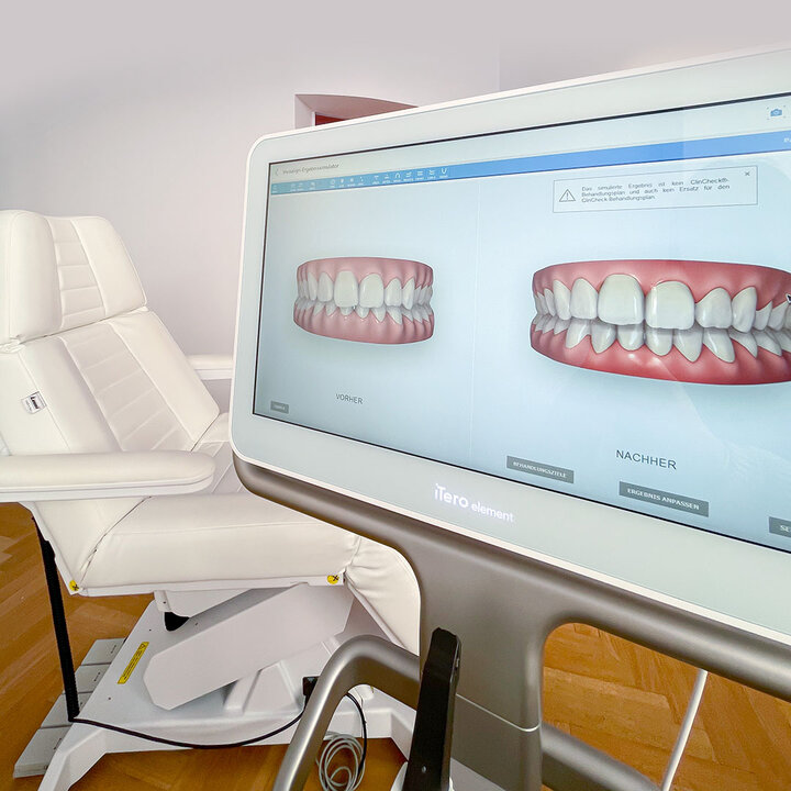 3D Simulation Invisalign Zahnspange