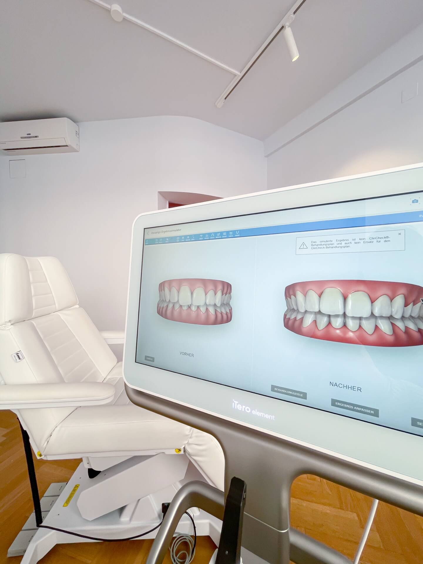 3D-Simulation deiner Zahnschiene