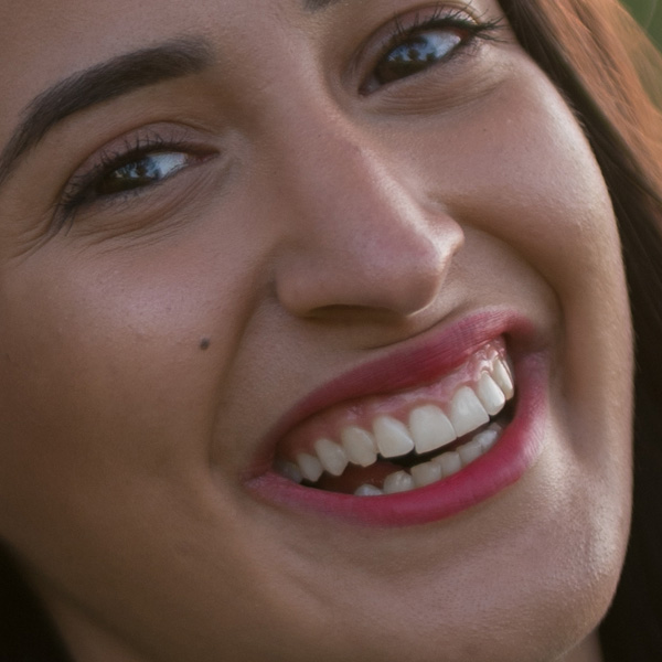 Close-up of Sarah's smile after treatment