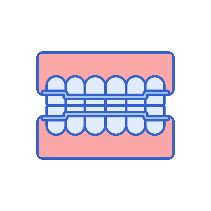 Retainer wire after braces treatment in Vienna