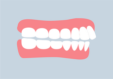 Vorstan mit Zahnspange behandeln