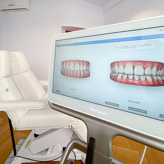 Mittels 3D Simulation planen wir Ihre Zahnregulierung